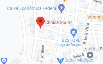 cli-sourir
